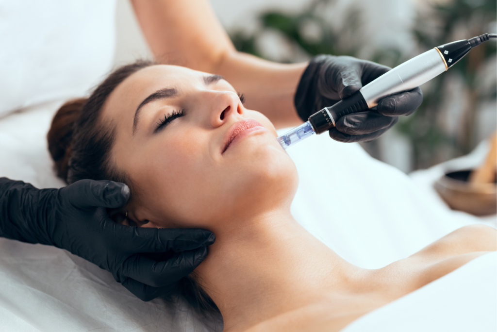 Microneedling